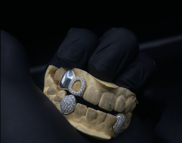 VVS Diamond Grillz (Caps)