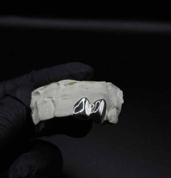 VVS Diamond Grillz (Caps)