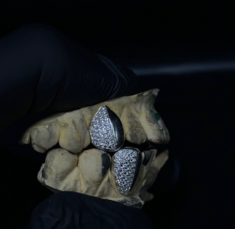 VVS Diamond Grillz (Caps)